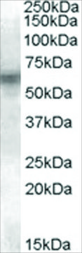 Anti-LYN antibody produced in goat