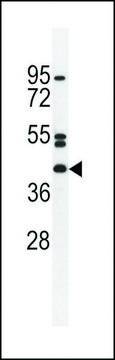 ANTI-NT5DC4 (CENTER) antibody produced in