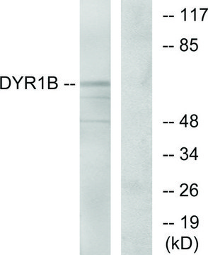 Anti-DYR1B antibody produced in rabbit