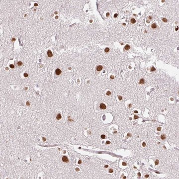 Anti-RIPPLY3 antibody produced in rabbit