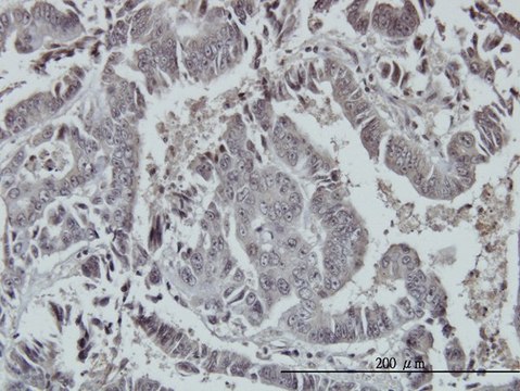 ANTI-FOXO3A antibody produced in mouse