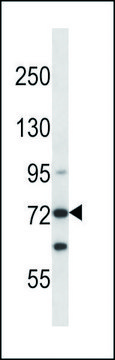 ANTI-MOUSE MYLK3 (N-TERM) antibody produced