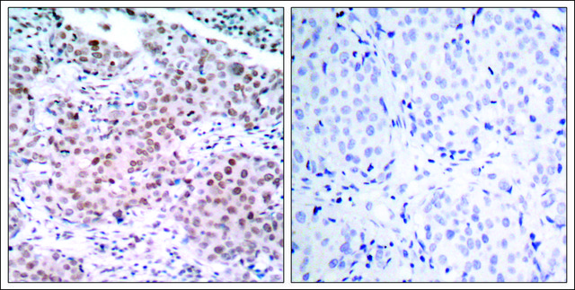 Anti-phospho-ESR1 (pSer¹??) antibody produced in