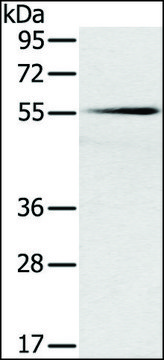 Anti-SLC16A10 antibody produced in rabbit