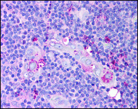 Anti-P53AIP1 antibody produced in rabbit