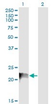 Monoclonal Anti-RRAS, (C-terminal) antibody produced