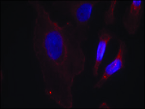Anti-phospho-PLCG2 (pTyr??³) antibody produced in