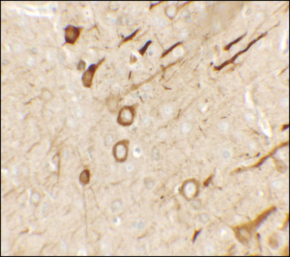 Anti-PRRT2 antibody produced in rabbit