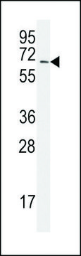 ANTI-SAE2 (UBA2) (C-TERM E616) antibody