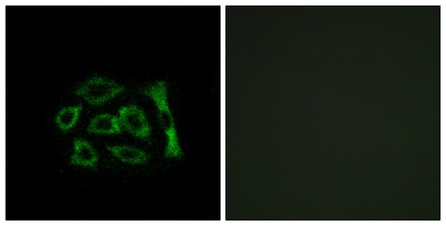Anti-ERD22 antibody produced in rabbit