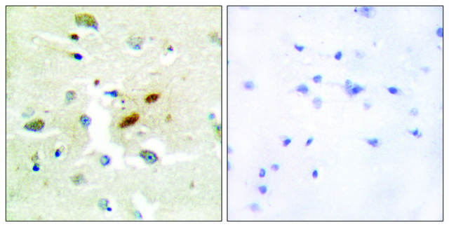 Anti-DNA Polymerase ? antibody produced