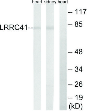 Anti-LRRC41 antibody produced in rabbit