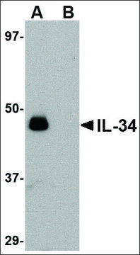 Anti-IL-34 (ab1) antibody produced in