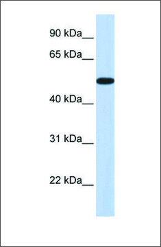 Anti-HOXA3 antibody produced in rabbit