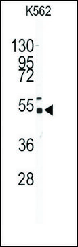Anti-GALK2 (N-term) antibody produced in