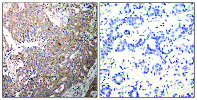Anti-KRT18 (Ab-33) antibody produced in