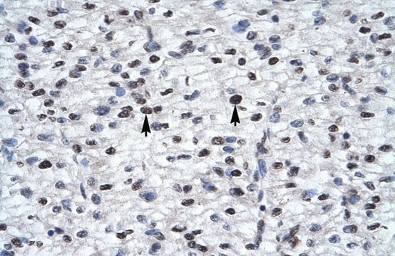 Anti-GLI2 antibody produced in rabbit