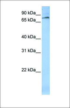 Anti-ALOX12 antibody produced in rabbit