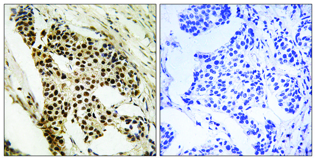 Anti-MAPKAPK2 antibody produced in rabbit