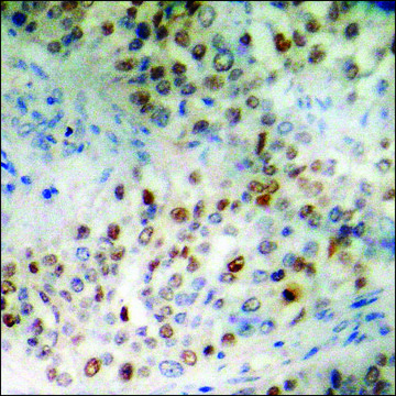 Anti-phospho-SP1 (pThr??³) antibody produced in