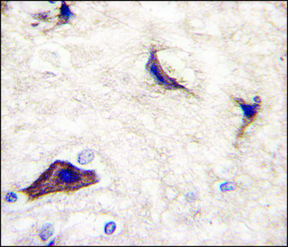 Anti-RASGRF1 (S929) antibody produced in