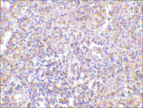 Anti-RAP80 (ab2) antibody produced in