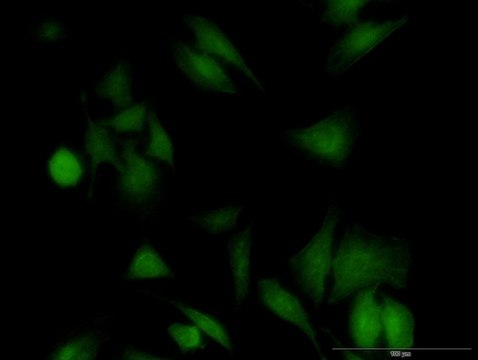 Monoclonal Anti-UBE2G1 antibody produced in