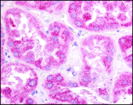 Anti-ESRRG antibody produced in rabbit