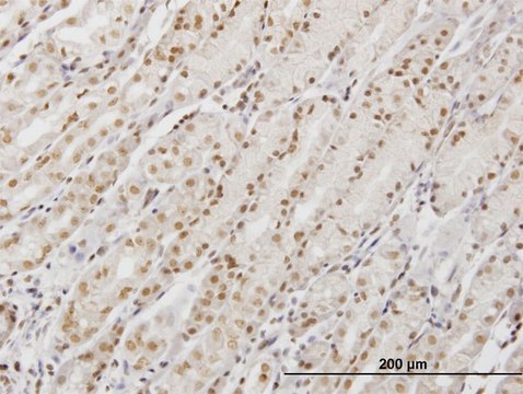 Monoclonal Anti-DDX54, (C-terminal) antibody produced