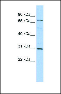 Anti-DMTF1, (N-terminal) antibody produced in
