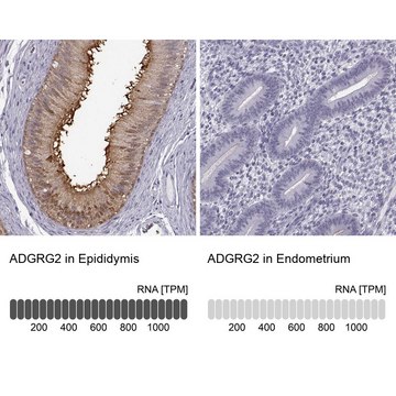 Anti-ADGRG2 antibody produced in rabbit