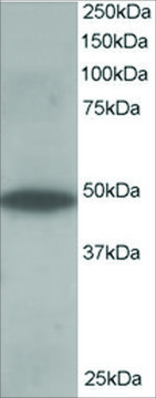 Anti-ORP1 antibody produced in goat