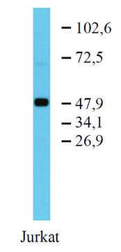 Monoclonal Anti-TFG antibody produced in