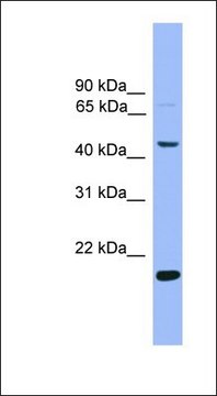 Anti-KLF4 antibody produced in rabbit