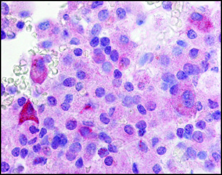 Anti-GPR37L1 (AB2) antibody produced in