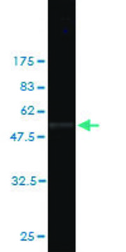 Monoclonal Anti-SLC45A2 antibody produced in