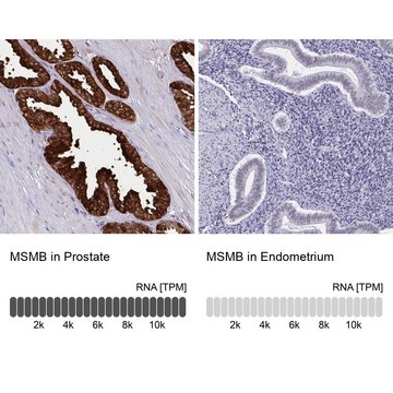 Anti-MSMB antibody produced in rabbit