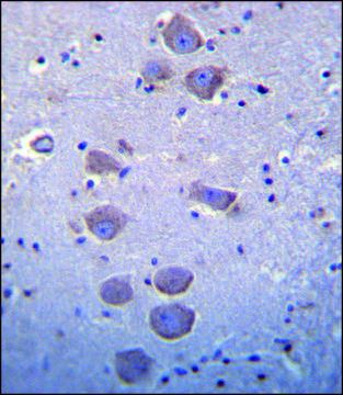 ANTI-MOUSE TLR8 (C-TERM) antibody produced