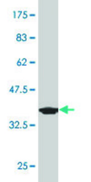 Monoclonal Anti-PDE1B, (C-terminal) antibody produced