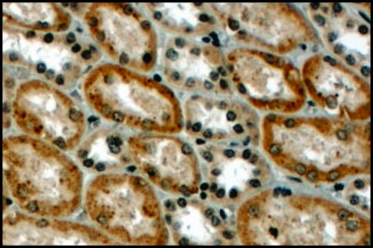 Anti-RNF34 (N-terminal) antibody produced in