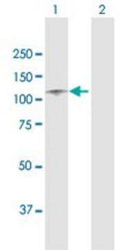Anti-ITIH1 antibody produced in rabbit