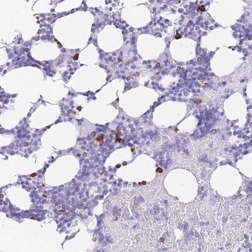 Anti-ZFP37 antibody produced in rabbit