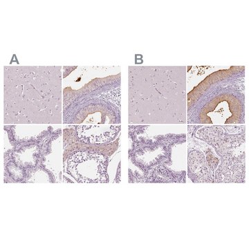 Anti-ELSPBP1 antibody produced in rabbit