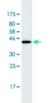 Monoclonal Anti-PIP5K3, (C-terminal) antibody produced