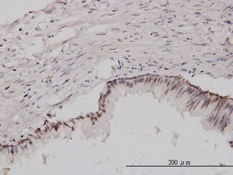 Monoclonal Anti-CSE1L antibody produced in