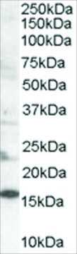 Anti-SH2D1A/SLAM Associated Protein antibody produced