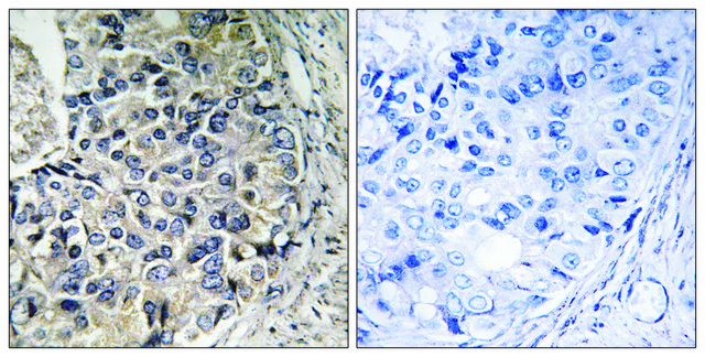 Anti-CMC1 antibody produced in rabbit