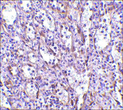 Anti-STIM1 antibody produced in rabbit