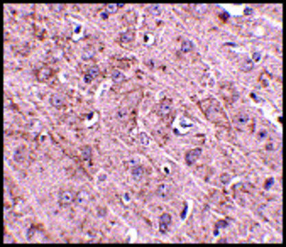 Anti-GLE1 (ab2) antibody produced in