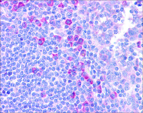 Anti-DLL1 antibody produced in rabbit